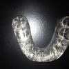 Orthodontie 4