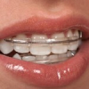Orthodontie 10