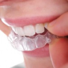 Orthodontie 9